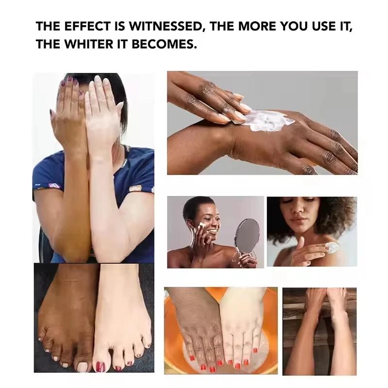 Body Whitening Bleach Cream Brighten Underarm Elbow Knees Joint Removal Intimate Parts Dark Spots Melanin Snow Bleach Cream