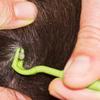 Pet Flea Removal Tool Kits Tweezers Tweezers Mite Anti Dog Ticks and Fleas Tick Tweezers Pet insect catcher
