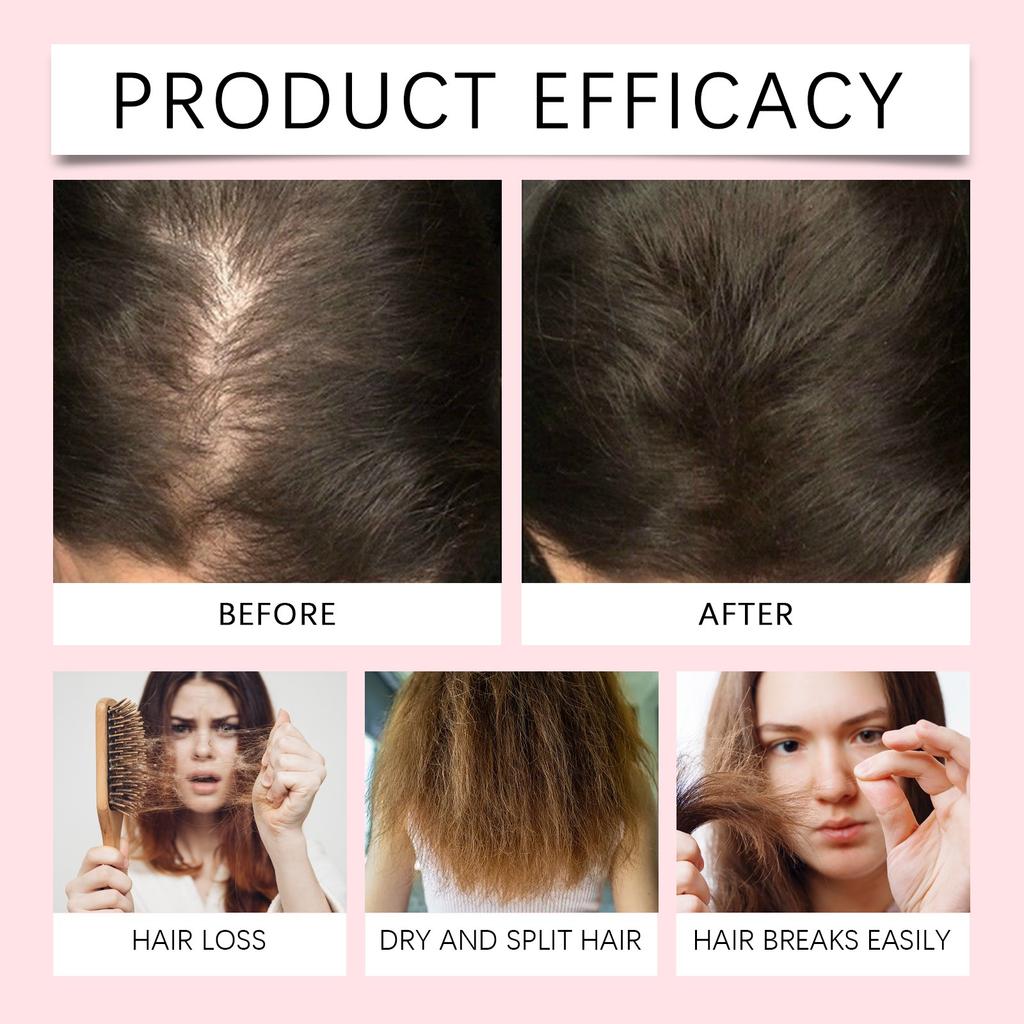 Hair Growth Spray Nourishes Hair Follicles Strengthens Hair  Hair Loss And Strengthens Hair To Promote New Hair Growth 100ml