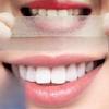 7Pairs Teeth Brightening Strips for Teeth 3D/5D/9D Whitener Strips Reduced Sensitivity White Strips for Teeth Whitening Products