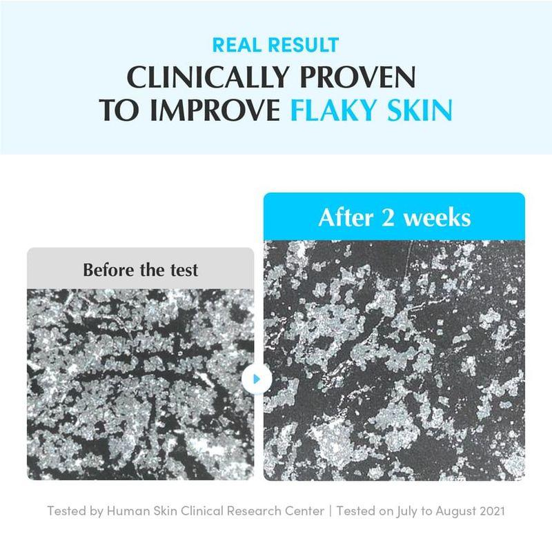 Eqqualberry Swimming Pool Daily Facial Toner 300ml Bundle Set