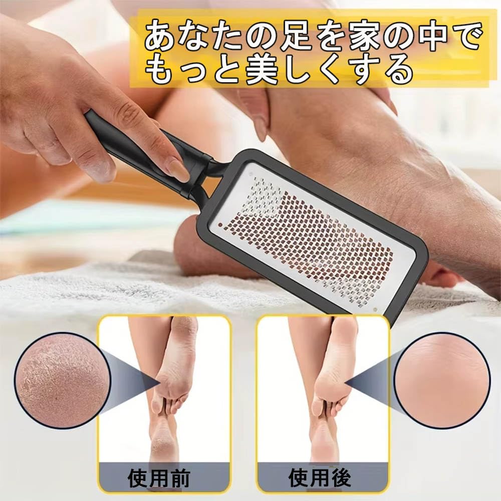 ZJYCLY Heel Callus Heel Foot Micro for Dry and Wet Cleans Black Remover, File, File, Cutter, Feet, Heels,