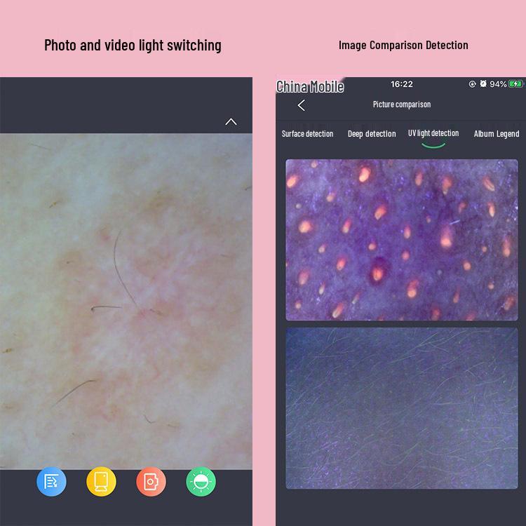 JHOT Wireless WiFi Magic Mirror Skin Analyzer: Three-Spectrum Epidermis, Dermis, UV Tester