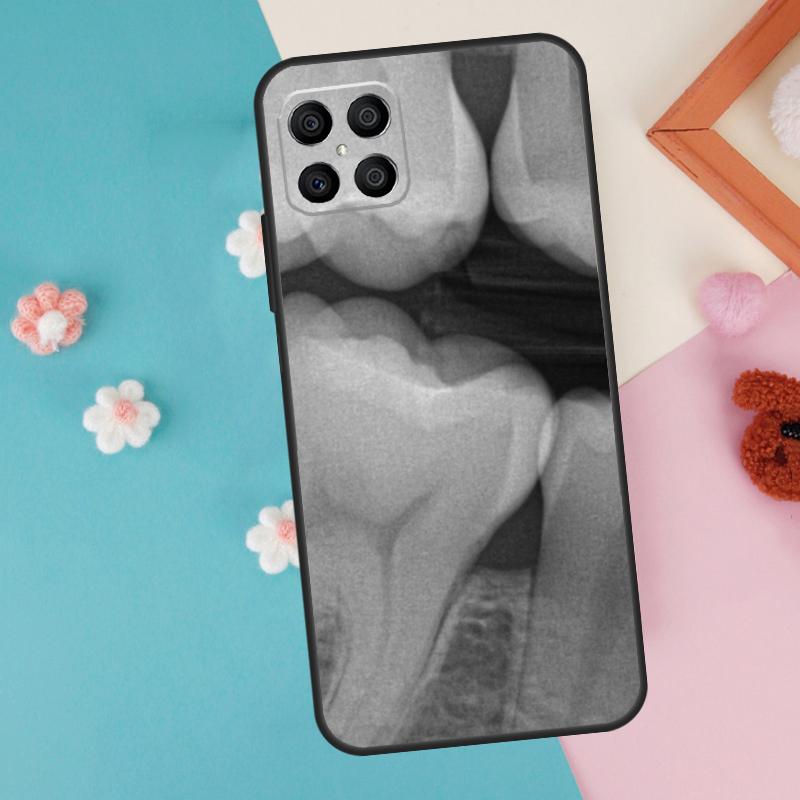 Dentist Dental Dent Tooth Case For Honor 200 Pro 50 70 90 X9a X8a X8 X9 X8b X9c X9b Honor Magic 7 Pro 5 6 Lite Cover