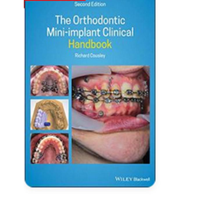 Klinisches Handbuch für kieferorthopädische Mini-Implantate Hardcover i085 UKN182