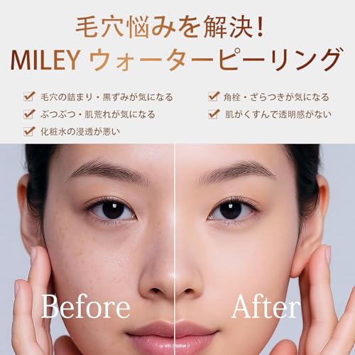 Wasser Peeling EMS mit Iontophorese, Ultraschall Peeling, Reinigung, Rotes, Blaues und Oranges Licht, Porenpflege, Peeling, Mitesserentfernung, Typ-C Ch