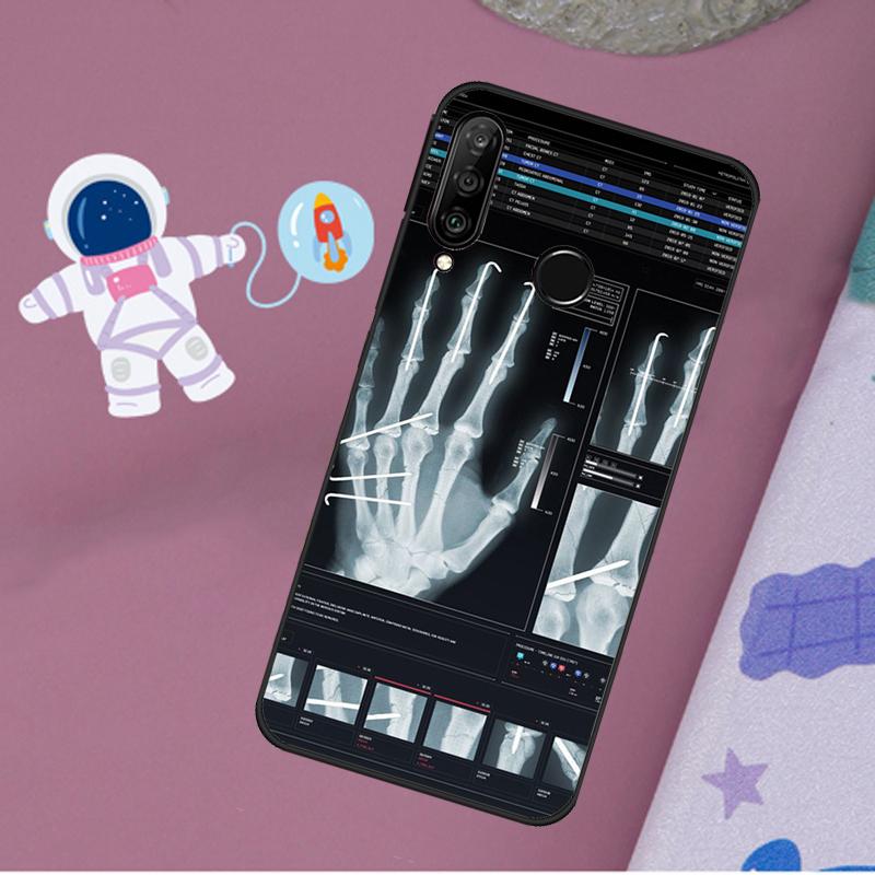 Radiological Human Organs Skeleton For Huawei Nova 12s 12i 11i 8i Y73 Y72 Y61 Y91 Y90 Y70 Y60 9 10 SE P30 P40 Lite P60 Pro Case