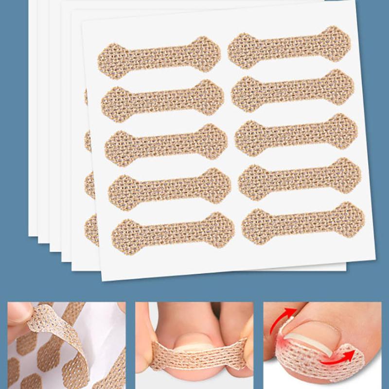 60Pcs Ingrown Paronychia Toenail Corrector Strips Anti Nail Patch Feet Sleeping Nail Patch Nails Into The Flesh Long Toe Pad