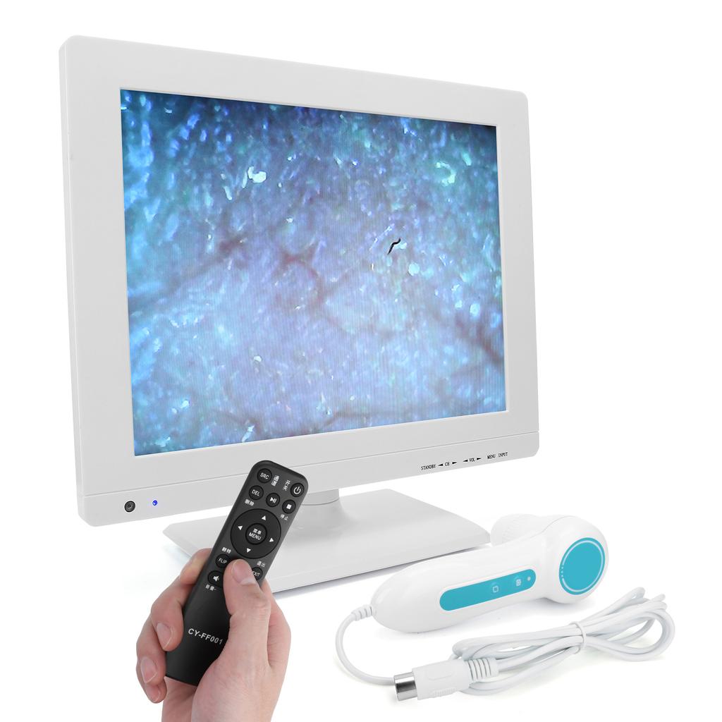 15 Inch 100X High Definition Scalp Detector Hair Follicle Analyzer Tester (100‑240V)EU Plug