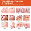 Herbal Foot Fresh Spray - Revitalizing & Sweat-Wicking | Botanical Blend