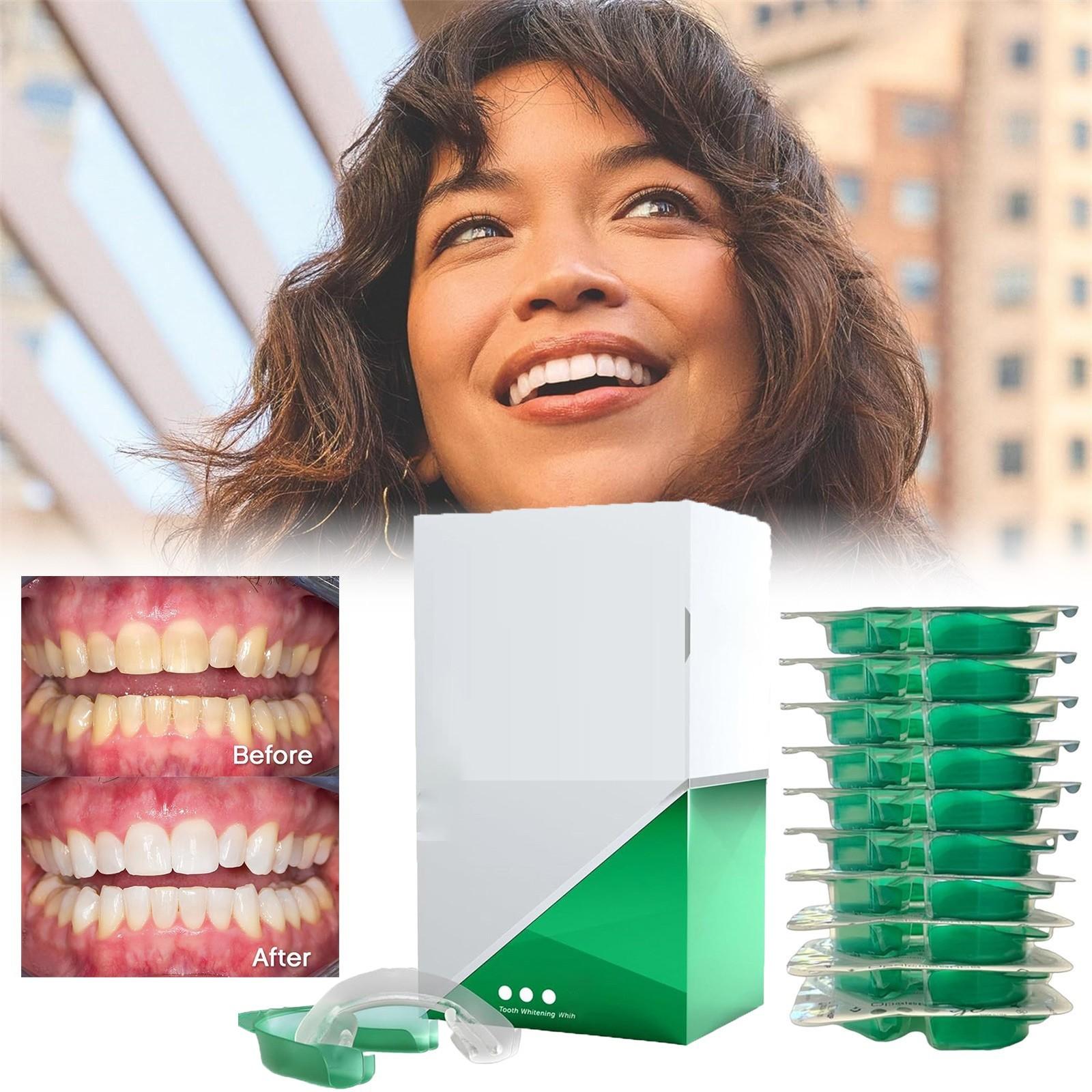 

Предварительно заполненный набор кап для отбеливания зубов One Size