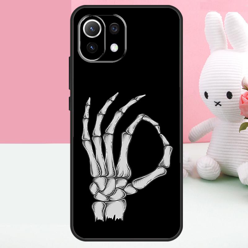 Skeleton Middle Finger Case For Xiaomi 15T 13T 14T 17 Pro Max 15 14 Ultra POCO X7 Pro X5 X6 F5 F6 F7 F8 Ultra Funda