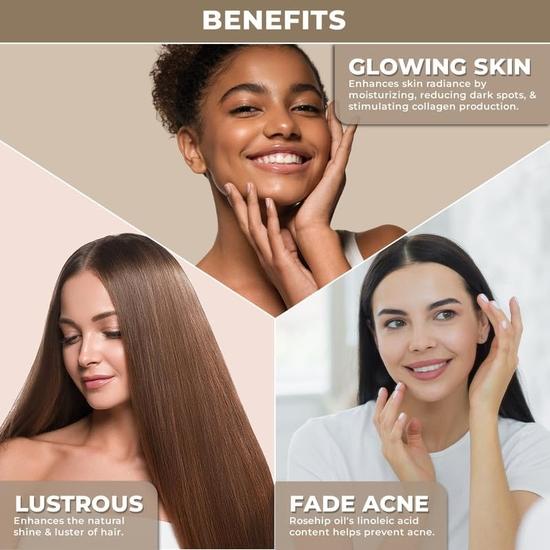 100% Plant Based Organic Rosehip Oil for Skin & Face – Pure and Cold Pressed Rose Hip Oil for Glowing, Hydrating & Nourishing Skin