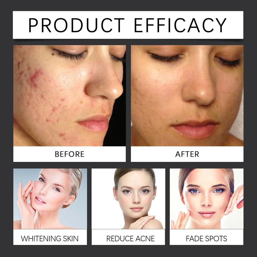 Centella Asiatica Brightening, Facial Whitening And Moisturizing Care, Rejuvenates Skin, Reduces Redness, Swelling And Skin Irritation, 30ML