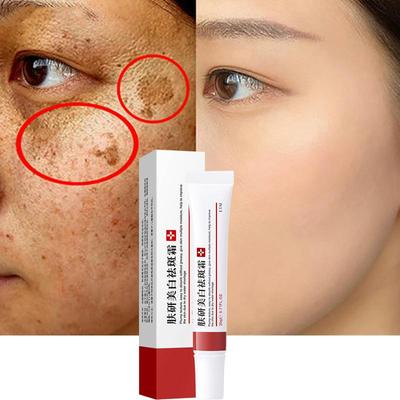 Crema sbiancante e anti-lentiggini Idratante Illuminante Crema viso per la rimozione delle lentiggini morbida e setosa rinfrescante non grassa