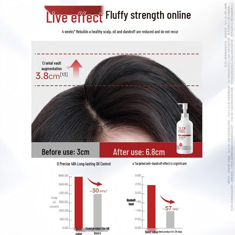 Slek PRO Oil Control & Anti-Dandruff Shampoo