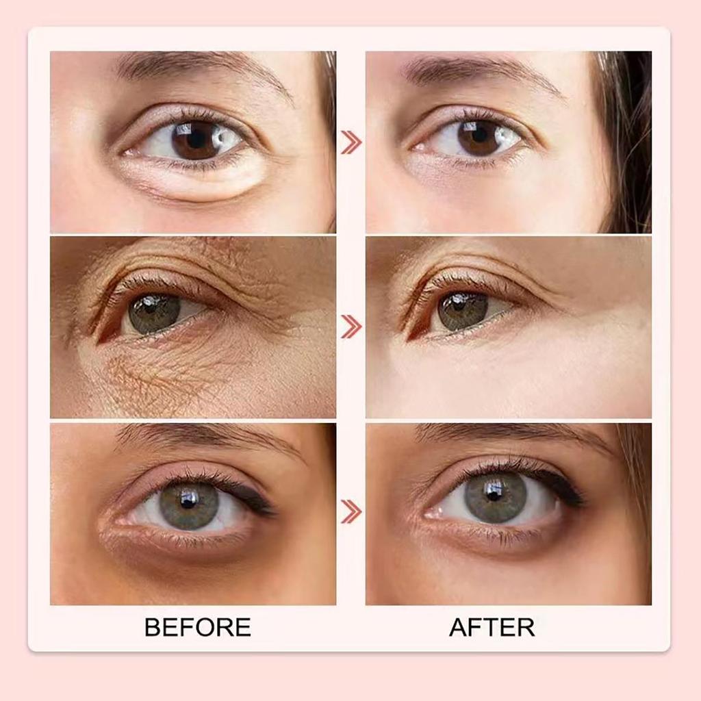 Reduces the Appearance of Dark Circles Around the Eyes, Removes Wrinkles, Tightens Wrinkles and Fine Lines, Moisturizes and Hydrates