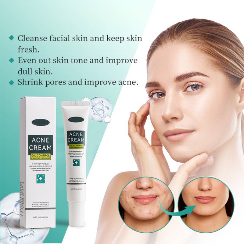 Kyselina salicylová Niacinamid Krém na akné 30g