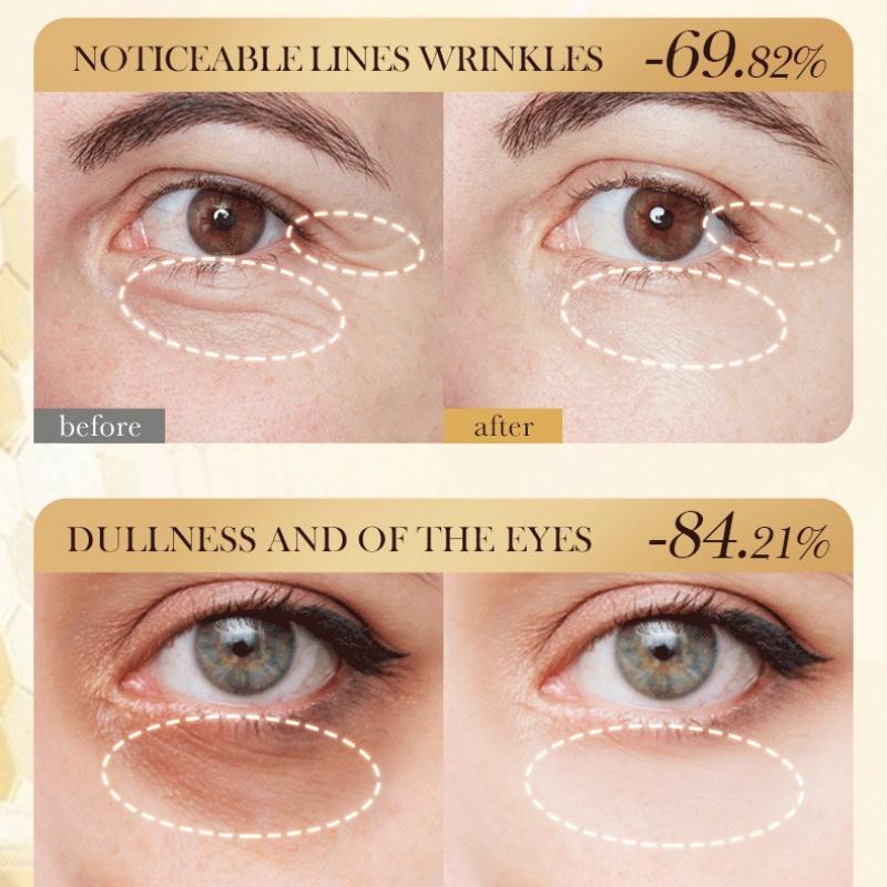 Bee Venom Anti-wrinkle Eye Cream SADOER Firming and Hydrating To Improve Dry Eye Cream