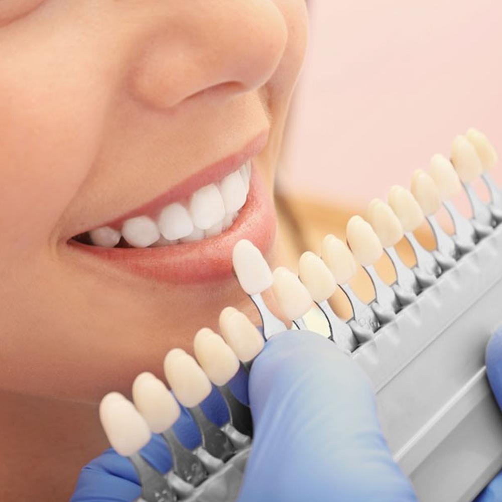NICEDEN Vita Toothguide 3D Master Teeth Whitening Bleach Shade Guide Przenośność 16 kolorów Klinika stomatologiczna Kolorymetryczna płytka