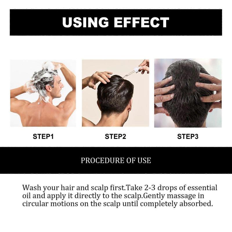 East Moon Hair Care Essence Moisturizes Dry Hair And Scalp Care Essence