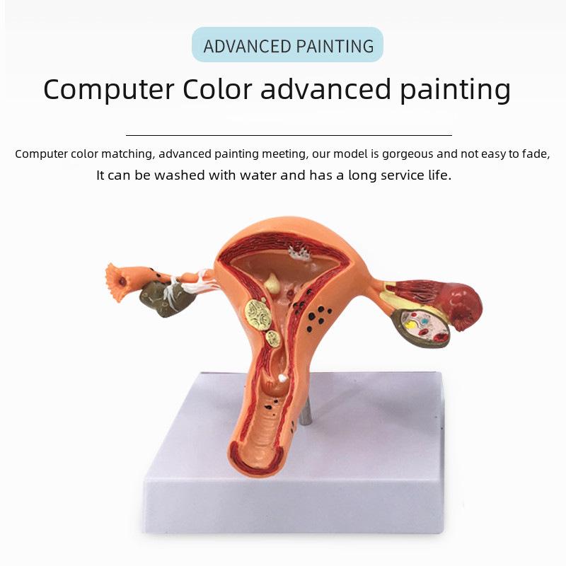 Large Female Reproductive Anatomy Model for Teaching and Family Planning