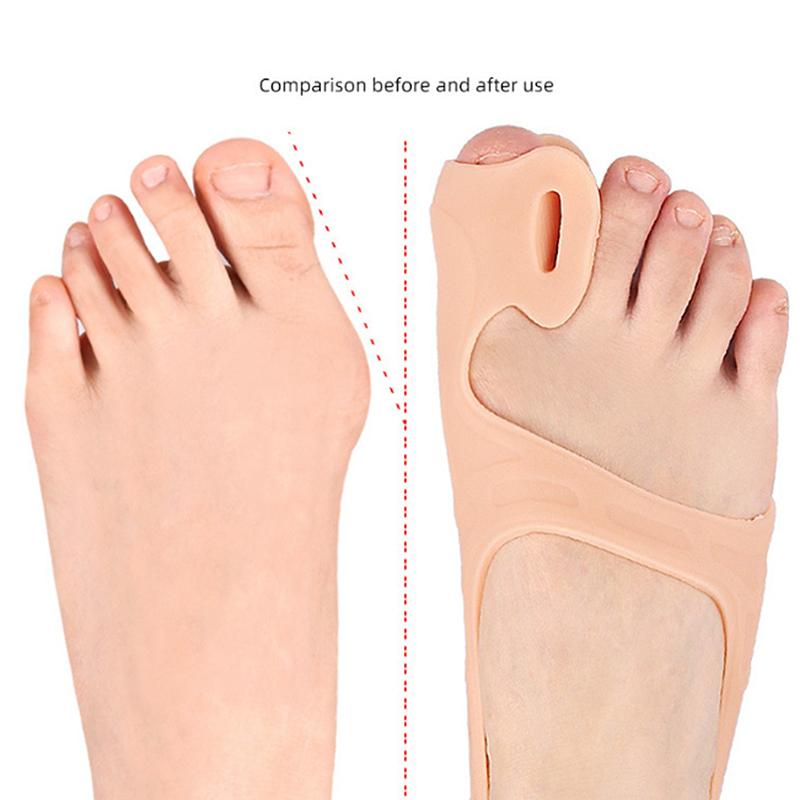 1Pc Big Toe Bunion Corrector Adjustable Orthopedic Socks Toes Separator Pain Relief Hallux Valgus Feet Protector