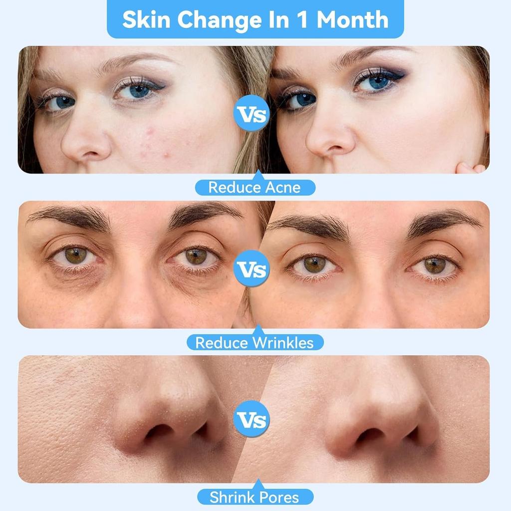 SC864 Diamond Micro-Dermabrasion Facial Machine, Professional Facial Deep Cleasing Tool, Home Use Facial Skin Care Equipment