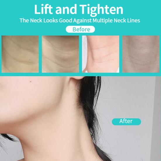 10Pcs Instant Neck Lifting Tape Invisible Natural Lift Strips for Necks Face Jaw Neck Wrinkle Reducing Strips Anti-aging Neck Patches