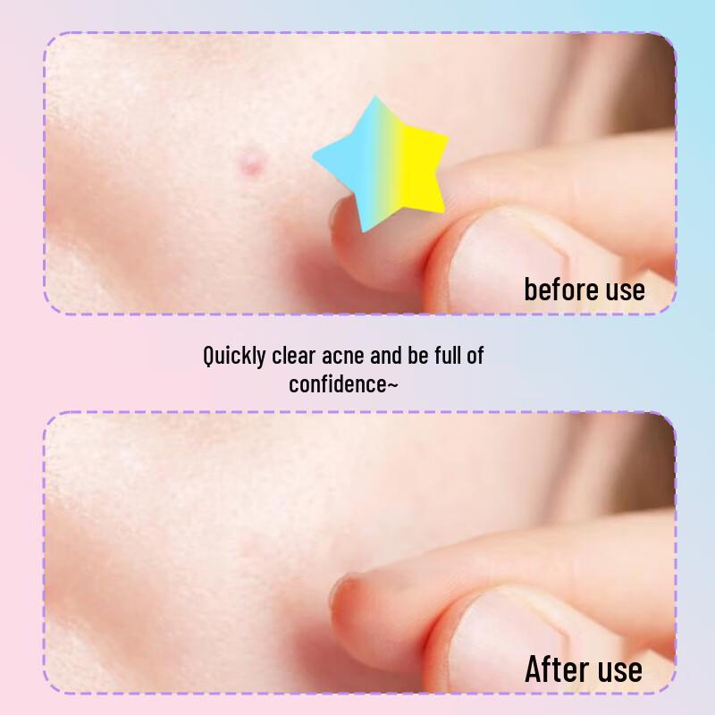 AUSLKA Beauty Colorful Star Pimple Patches