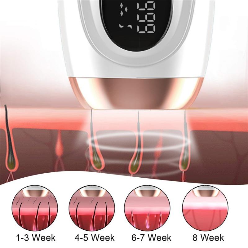 Épilateur Laser Permanent à impulsions IPL 990000, indolore, pour femmes et filles, épilation à usage domestique