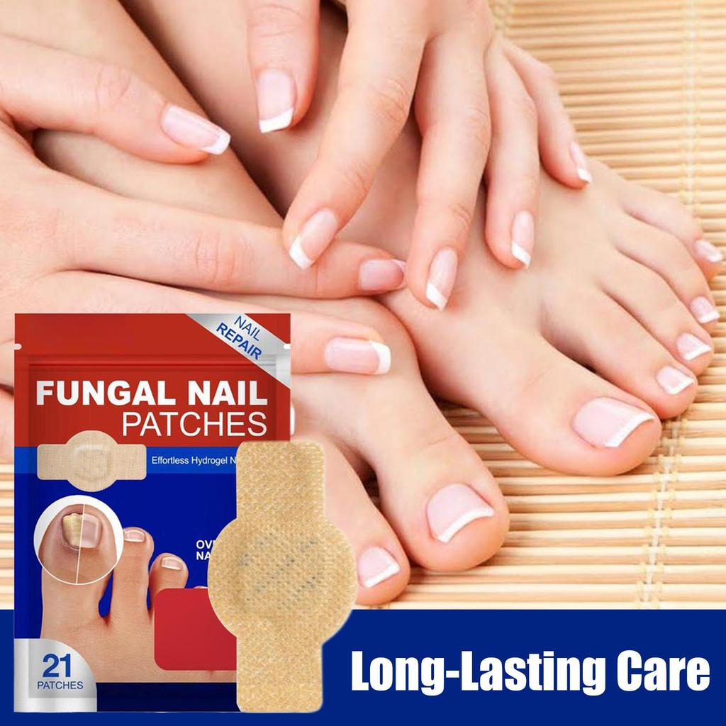 NailFungus Patch Waterproof Nail Repair Patch Ingrown Correction Sticker Damaged Nail Gray Care Patch Feet Care Tools