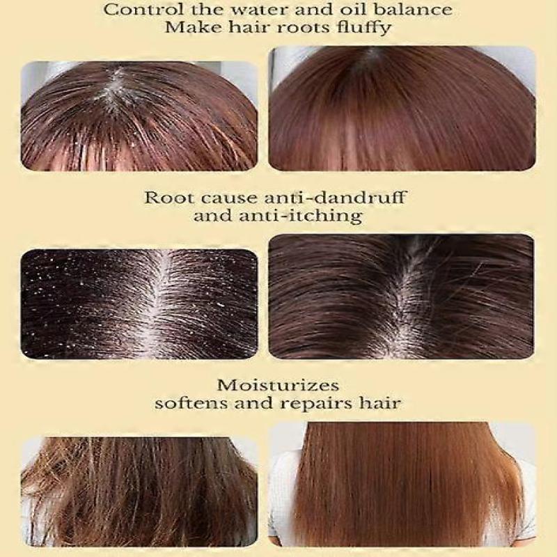 Batana Oil Scalp Scrub, 2-in-1 Shampoo Scalp Exfoliator for Hair Treatment, Includes Silicone Scalp Massager, Removes Buildup & Dandruff, 300g