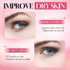 Strawberry Eye Cream 20g VC Moisturizing Hydrating Brightening Eye Moisturizing Eye Cream Skin Care Products