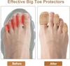 Big Toe Bandage Wrap Stretchy Toe Tape Protect Toes & Fingers From Pain Relief Self Adhesive Bandage Wrap Suitable For Thumb