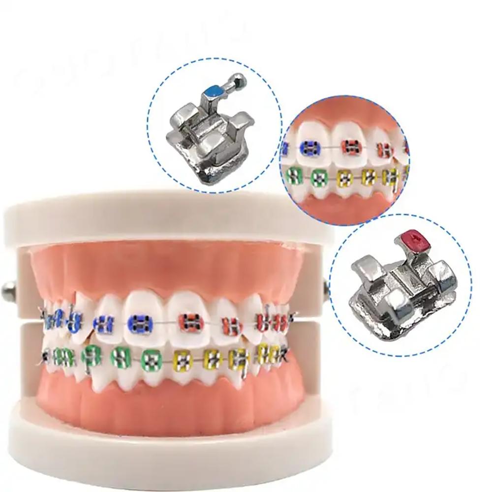PIORPOY 20Pcs/Kit Dental Orthodontic Braces For Teeth MIM Monoblock Metal Mini Standard Roth MBT Slot 0.022 0.018 Hooks 3-4-5 3