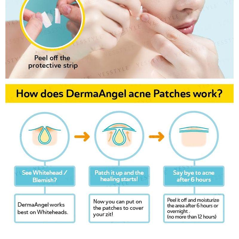 DermaAngel - Náplasti na akné pro denní použití 24 ks