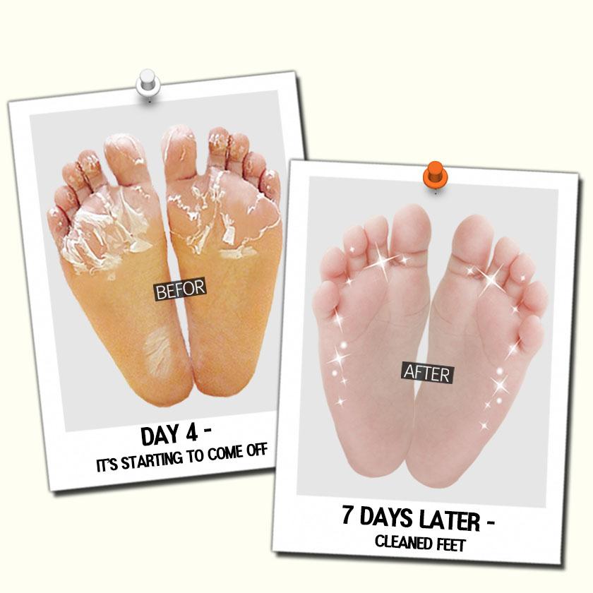 [KOREA AUTHENTIC] [DOUBLE&ZERO] Double Effect Foot Feeling Mask 1P 3P 5P