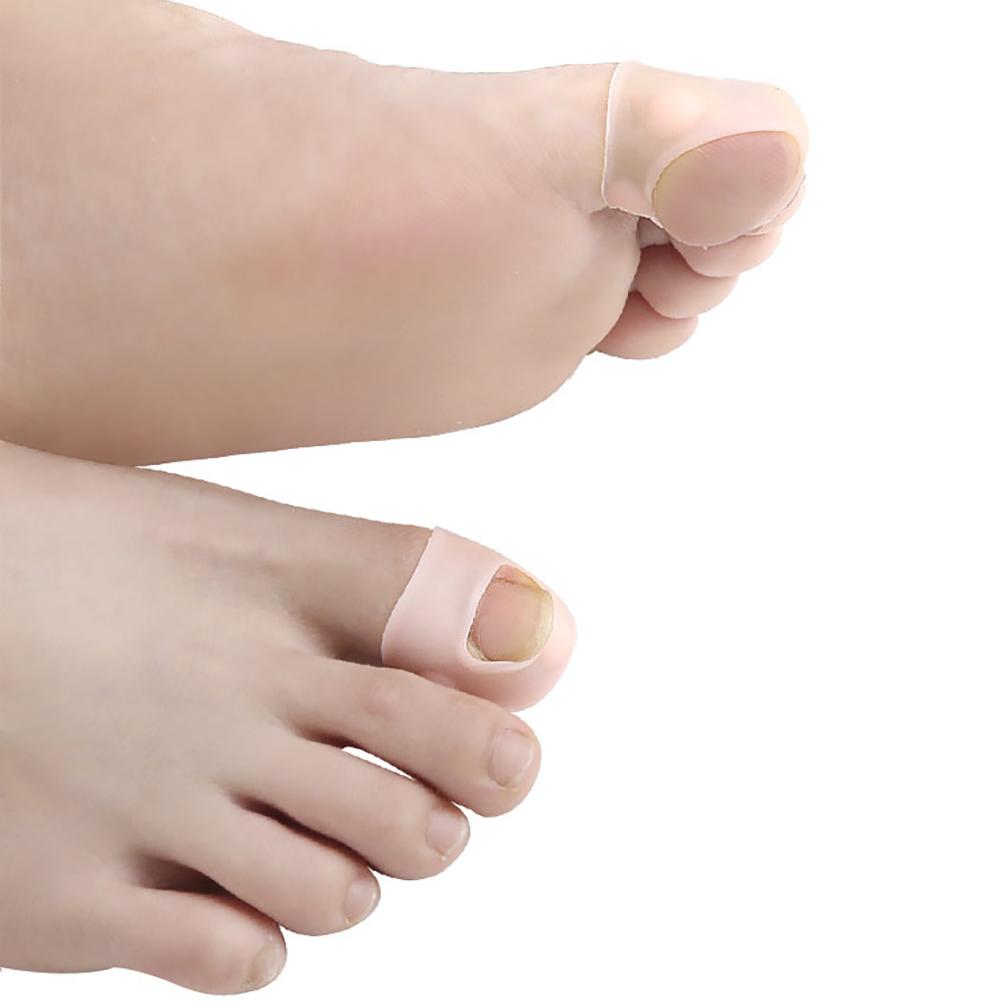 Verktyg för korrigering av inåtväxt tånagel Elastisk tånagelsrätare Silikon tånagelskorrektorer