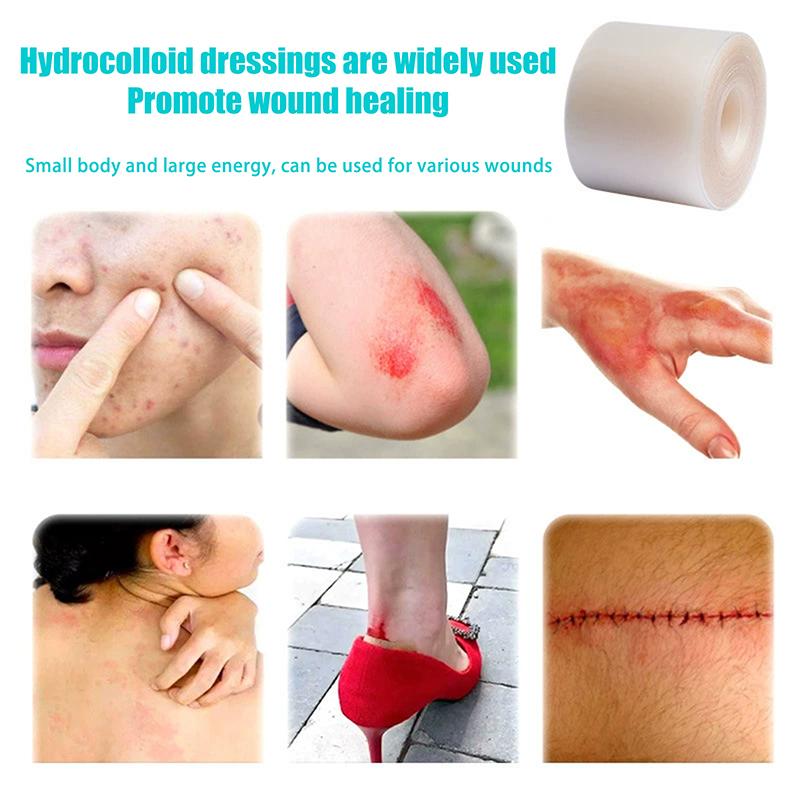 1 Rolle Hydrokolloid-Pflasterverbände für effektive Wundversorgung Extra dünn Weich Wasserdicht Selbstklebend Narbenabdeckungstape