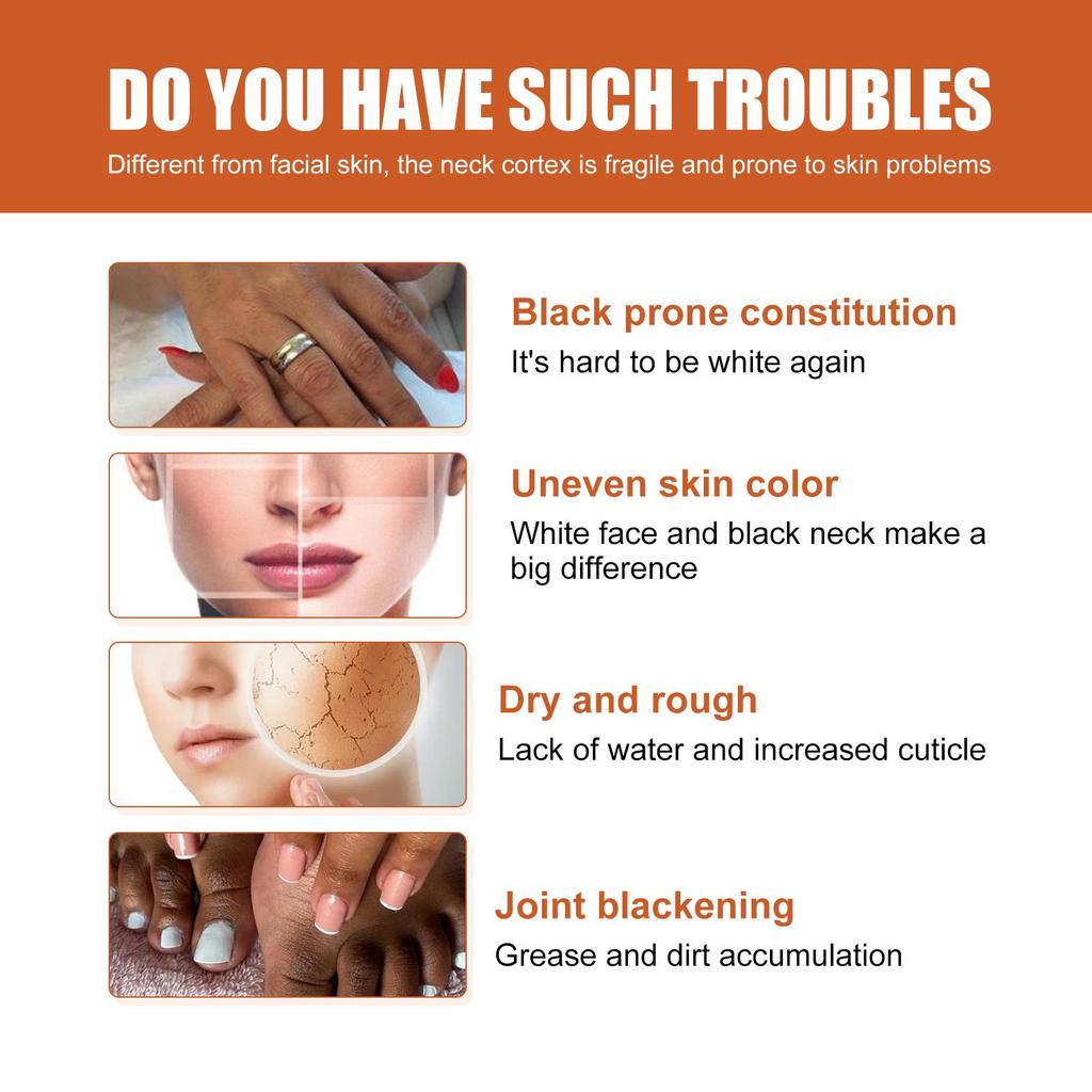 50ml Skin Beauty De-Tanning Serum Brighten Skin Tone Knee & Ankle Corner De-Marker Moisturizing Serum