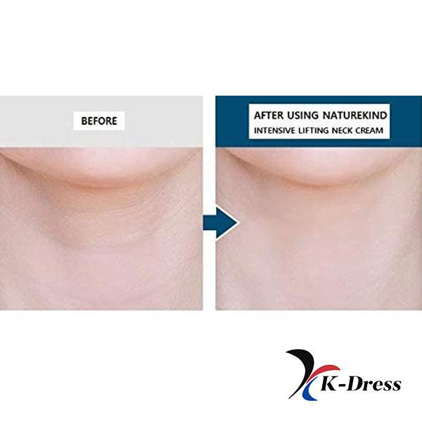 NATUREKIND Intense Lifting Neck Cream 50g