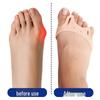Double-Hole Toe Separator & Shock-Absorbing Arch Pad - Pressure-Relieving Bunion Corrector for Forefoot Comfort