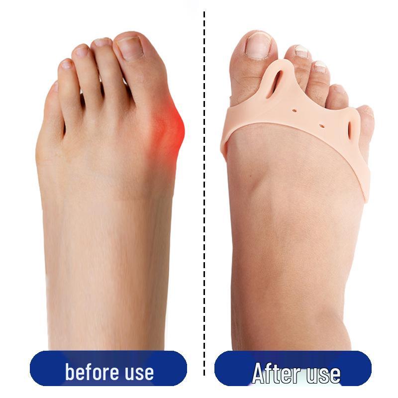 Double-Hole Toe Separator & Shock-Absorbing Arch Pad - Pressure-Relieving Bunion Corrector for Forefoot Comfort