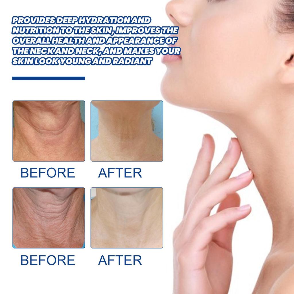 EELHOE Collagen Neck Cream Lightens Neck Fine Lines Wrinkles Anti-aging Lifts Tightens Skin Moisturizing Neck Whitening Cream