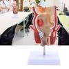 Human Pathologies of Rectum Model Medicals Teaching Tool Human Rectum Model Human Anatomy Model Teaching Supplies