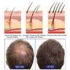 East Moon Men's Hair Thickening Foam - Repairs Hair Follicles, Makes Hair Thicker And Nourished
