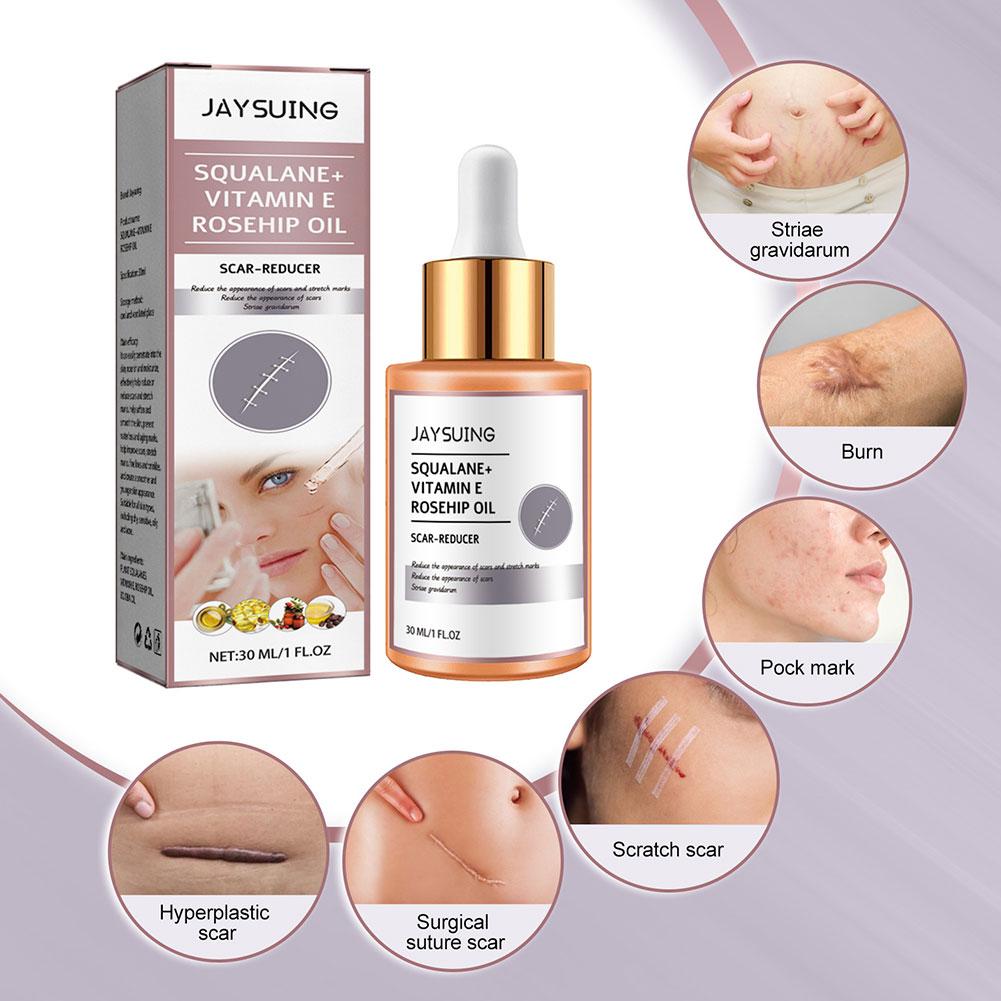 Scar Surgery Scar Dilution Cream To Burn The Impression Scar Dilution Surgery Beard Cream Remov I3U7