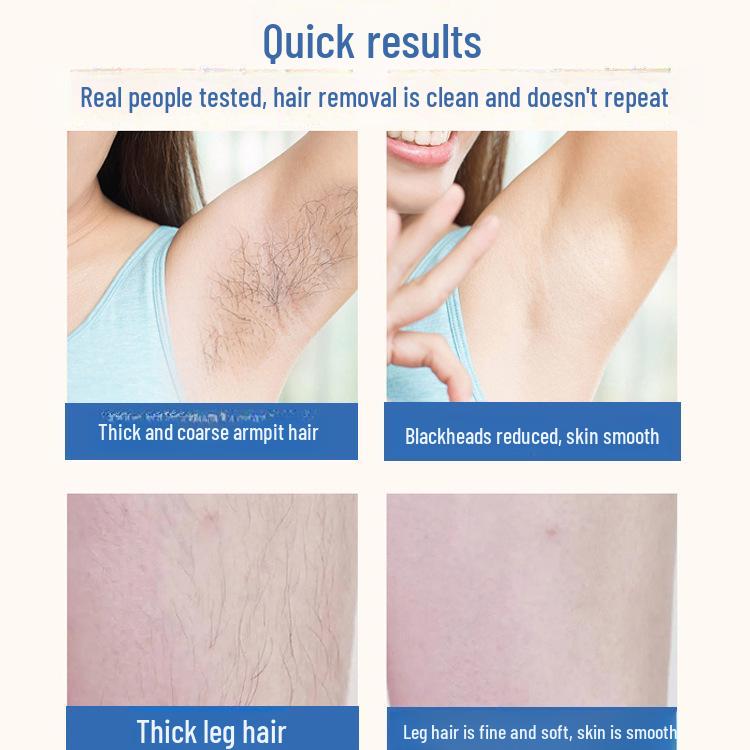 Appareil d'épilation laser IPL compact pour usage domestique et clinique