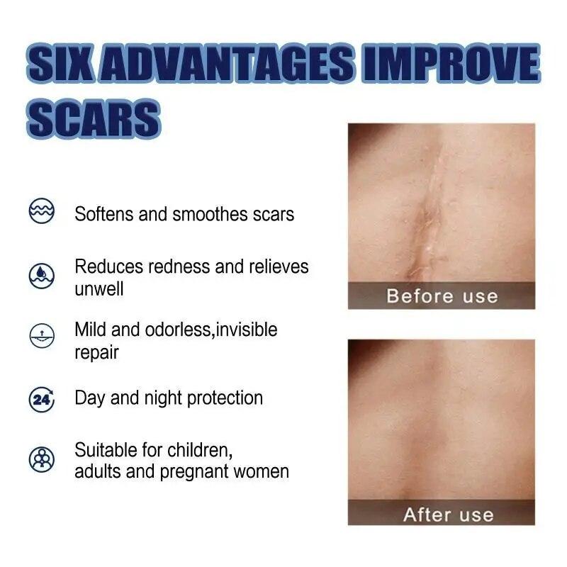 Scar Repair Cream Surgery Scars Pregnancy Scars Fade Repair Recovery Smooth And Delicate Skin Care Cream